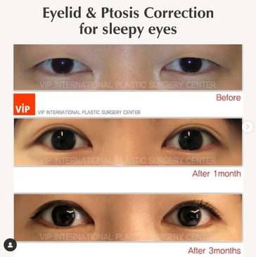 Slider image (2) VIP Plastic Surgery